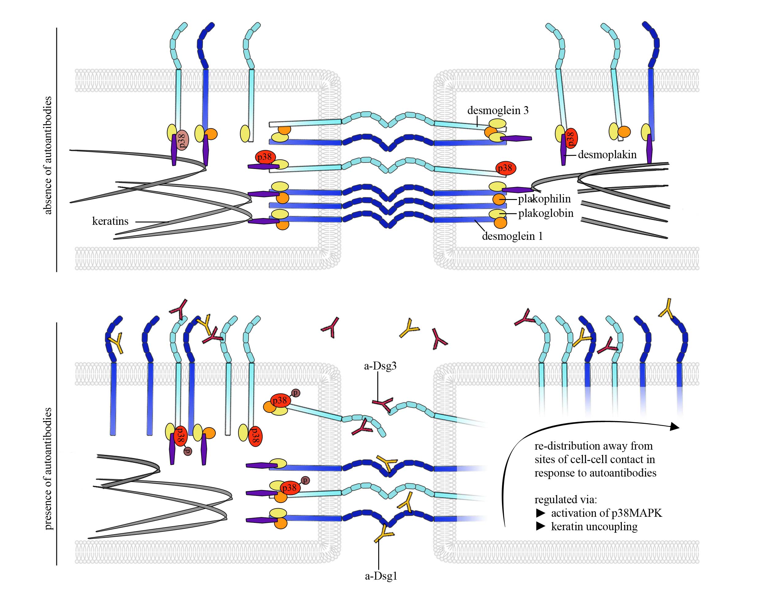 desmosomes and cancer