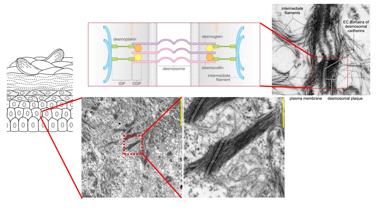 desmosom